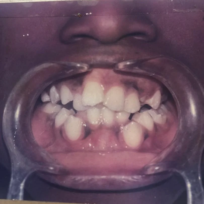 braces treatment in victoria island